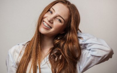 Everything You Need to Know about Adult Ceramic Braces