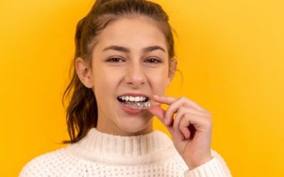 Different braces.  Different costs.  What’s the best option for you?