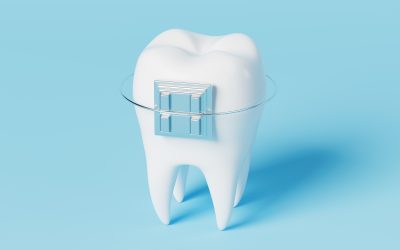 What Braces Can You Get on the NHS?