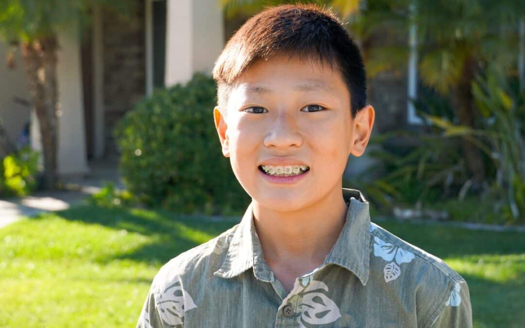 A Parent’s Guide to Kids Braces: What You Need to Know