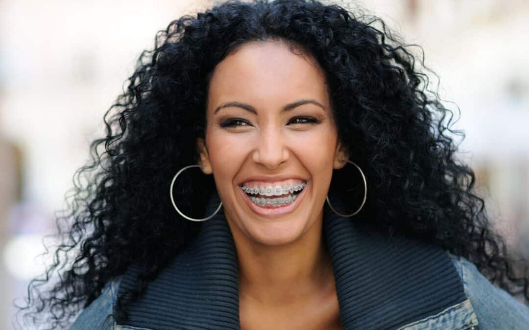 Celebrating the Classics: Unveiling the Timeless Charm of Traditional Braces