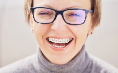 Life-Changing Benefits of Braces for Adults: What You Need to Know